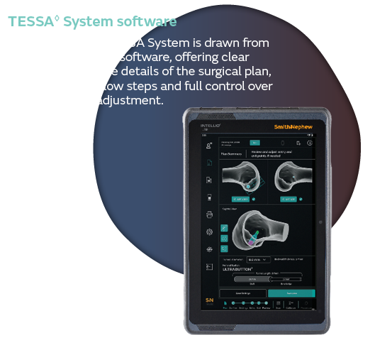 TESSA System Software
